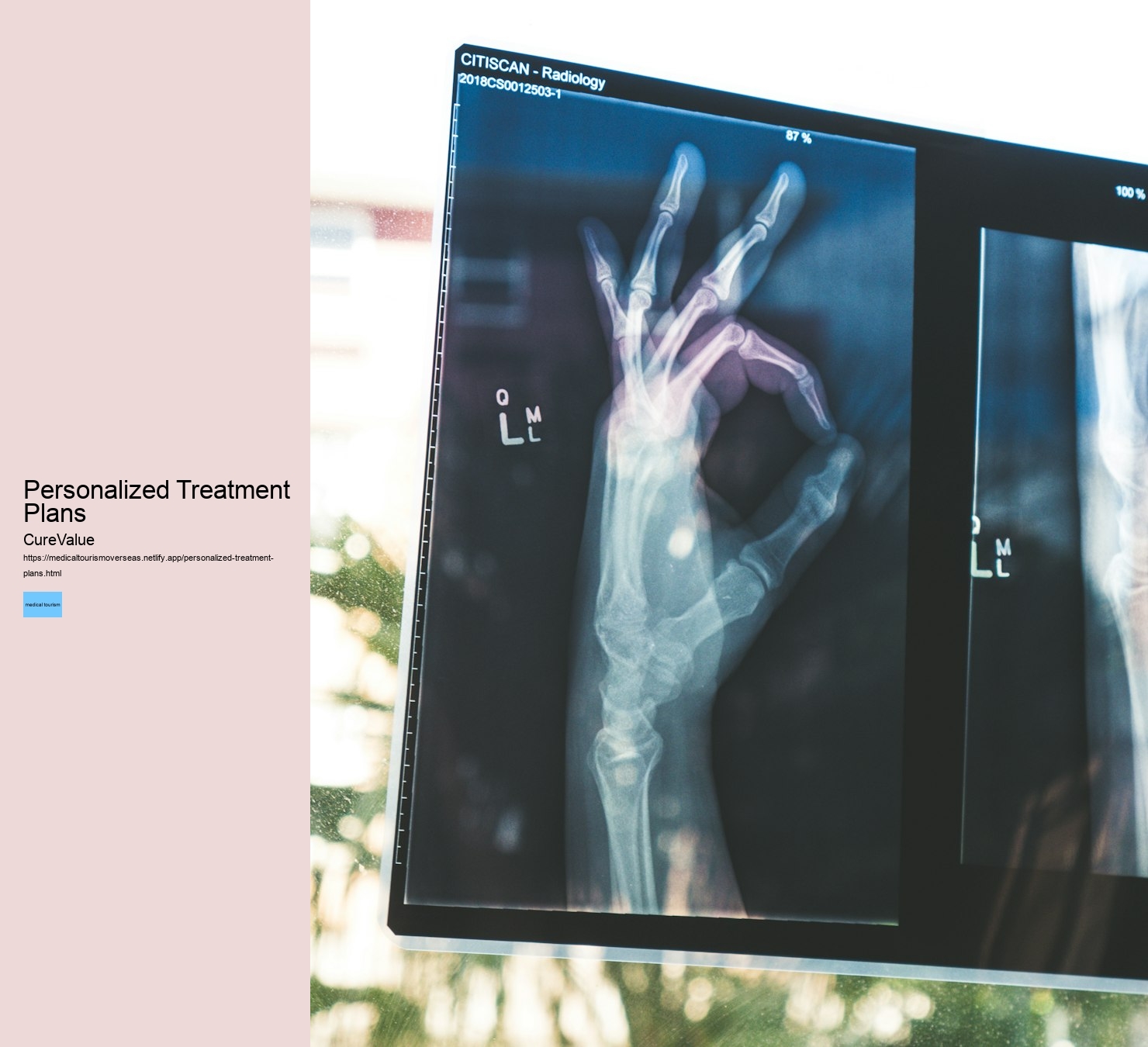 Personalized Treatment Plans